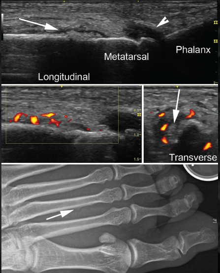 A 30-Year-Old Woman with Left Foot Pain 