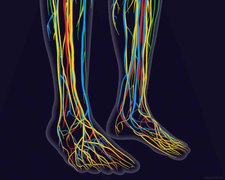 Small Fiber Neuropathy for the Rheumatologist - The Rheumatologist